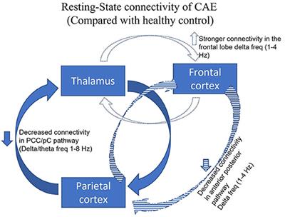 Contributions of Magnetoencephalography to Understanding Mechanisms of Generalized Epilepsies: Blurring the Boundary Between Focal and Generalized Epilepsies?